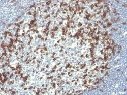 PD-1 Antibody (PDCD1/922), Novus Biologicals 0.2mg; Unlabeled:Antibodies,